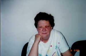 The day after surgery